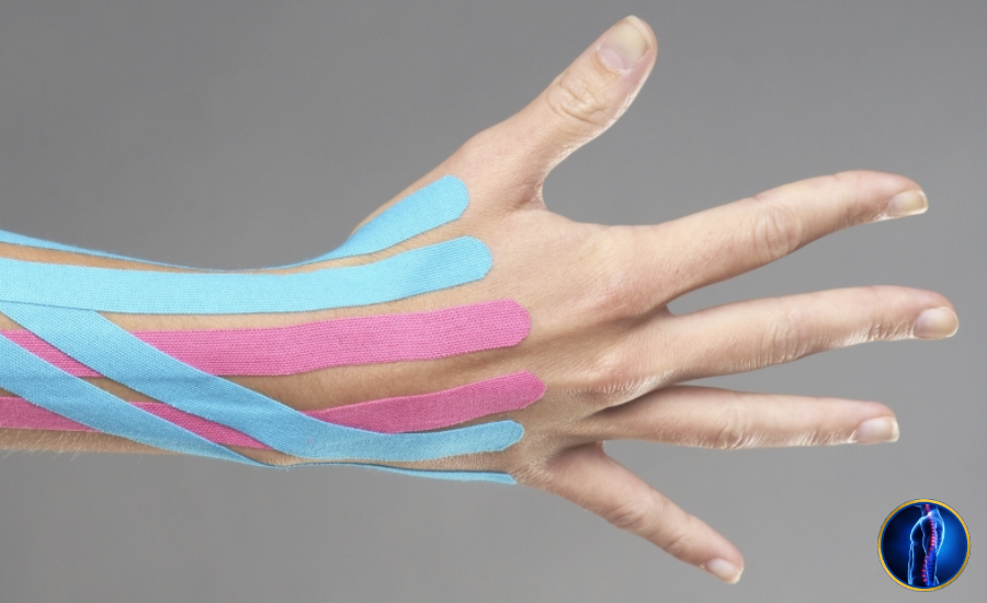 Kinesiotape Neuromuscolare